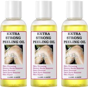 Fabixoin Olio Peeling Extra Forte, Olio Peeling Giallo Sicuro Extra Forte, Potente Scrub Corpo Contro Smagliature E Sport Scuri, Sbiancante Super Potente Per La Pelle Scura