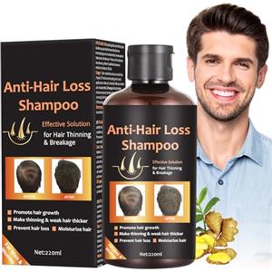 QEEROYO Shampoo Anticaduta, Ricrescita Capelli, Anti Hair Loss, Shampoo Anti-Caduta Fortificante, Prevenire la Perdita di Capelli Perdita, Hair Regrowth 220ml