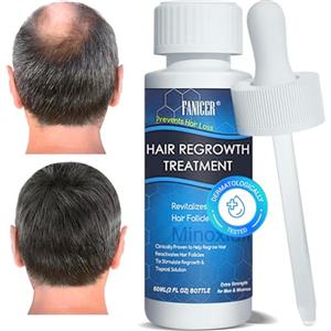 gelpretty 60ml Siero Capelli, Favorisce la Ricrescita Naturale e Rafforza le Radici, Per Tutti i Tipi di Capelli,Rendere i Capelli Più Folti, Uomo e Donna