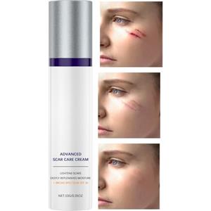 Generisch Crema cicatriziale Contro cicatrici da ustioni, Crema cicatriziale Contro cheloidi, Idratante Macchie Rimozione 30 Per Corpo Viso 'urto Keloide Taglio Cesareo Incendio