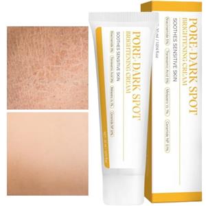 Generico Crema Schiarente Per La Pelle - Lozione Idratante 30ml - Trattamento Schiarente Per Pelle Scura,Per Donne E Uomini Per Attenuare Le Cicatrici E Donare Luminosità