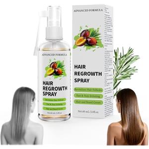 VIVEY Olio Di Ricino/Biotina/Olio Di Rosmarino Siero Capelli,Crescita Capelli Veloce Donna/Uomo,Ricrescita Capelli Donna/Uomo,Siero Spray Per Capelli Per,Favorisce Capelli E Barba, 60ml
