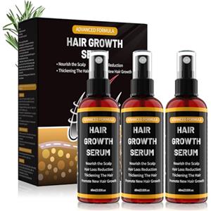 Rouclo Hair Growth Serum con Olio di Rosmarino, Olio di Ricino & Biotina - 3x60ml | Siero Anticaduta per Uomini e Donne, Cura Naturale per Capelli, Cute e Barba