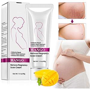 Fengyang Crema cicatrice Smagliature, Rimozione Cicatrici Da Gravidanza, Trattamento Smagliature, Riparazione Maternità, Rimozione Smagliature Dalla Gravidanza