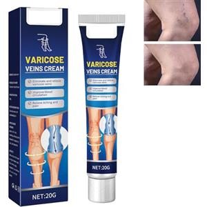 GNAUMORE Varicose Vein Crème,Veins Cream,Idratante Per Vene Varicose,Crema Vene Varicose,Vene Varicose,Riduce Le Vene Varicose,Crema Per La Cura Delle Gambe,Crema per Vene Varicose