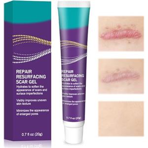 Mtskaeo Gel per Cicatrici,Gel silicone per cicatrici bambini e adulti,Crema Per Migliorare l'Aspetto, Adatta a Viso e Corpo,Texture Leggera e Rapido Assorbimento