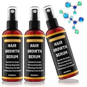 Aisisree Spray Siero per la Crescita dei Capelli per Uomo e Donna, Accelerare la Crescita dei Capelli, Anticaduta Capelli, con Olio di Rosmarino, Olio di Ricino (Castor Oil) e Biotina, 60 ml × 3